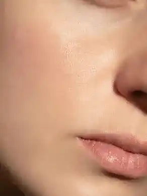 After using Kinure kit