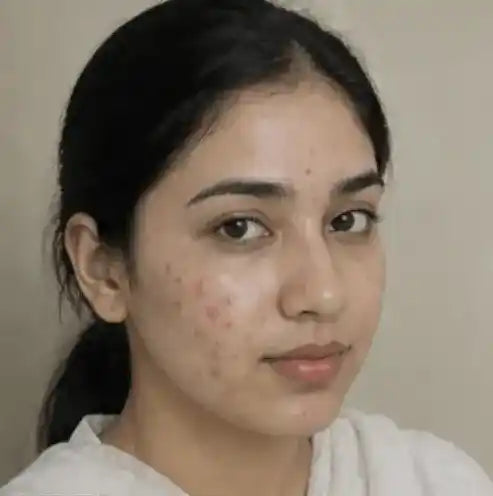 Before using Kinure kit