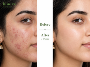 Kinure Acne Kit